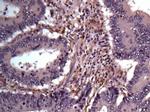 AKR1B1 Antibody in Immunohistochemistry (Paraffin) (IHC (P))