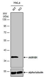 AKR1B1 Antibody