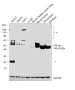 ATP1B1 Antibody in Western Blot (WB)