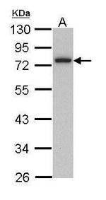 Calpain 3 Antibody in Western Blot (WB)