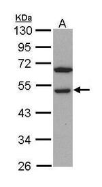 RCC1 Antibody in Western Blot (WB)