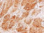 CRMP2 Antibody in Immunohistochemistry (Paraffin) (IHC (P))