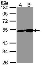 NSE Antibody in Western Blot (WB)