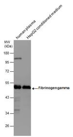 Fibrinogen gamma Antibody in Western Blot (WB)