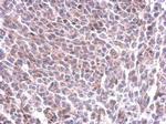 GYS1 Antibody in Immunohistochemistry (Paraffin) (IHC (P))