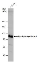 GYS1 Antibody in Western Blot (WB)