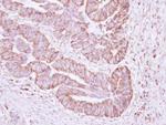 ERAB Antibody in Immunohistochemistry (Paraffin) (IHC (P))