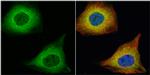 TAGLN Antibody in Immunocytochemistry (ICC/IF)