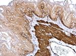 TAGLN Antibody in Immunohistochemistry (Paraffin) (IHC (P))