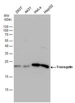 TAGLN Antibody in Western Blot (WB)