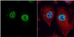 LXR beta Antibody in Immunocytochemistry (ICC/IF)