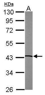 LXR beta Antibody in Western Blot (WB)