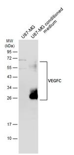 VEGFC Antibody in Western Blot (WB)