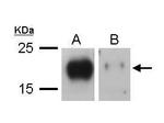 VEGFC Antibody in Western Blot (WB)