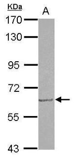 GDF5 Antibody in Western Blot (WB)