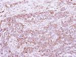 DLC1 Antibody in Immunohistochemistry (Paraffin) (IHC (P))