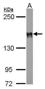 DLC1 Antibody in Western Blot (WB)