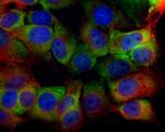 SR-BI Antibody in Immunocytochemistry (ICC/IF)