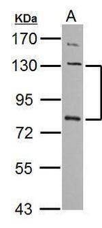 P-cadherin Antibody in Western Blot (WB)