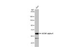 CHRNA4 Antibody in Western Blot (WB)