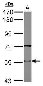 CHRNB2 Antibody in Western Blot (WB)