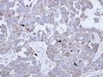 CSF2RB Antibody in Immunohistochemistry (Paraffin) (IHC (P))