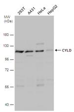 CYLD Antibody in Western Blot (WB)