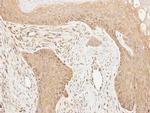 Cortactin Antibody in Immunohistochemistry (Paraffin) (IHC (P))