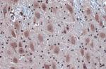 IRE1 alpha Antibody in Immunohistochemistry (Paraffin) (IHC (P))