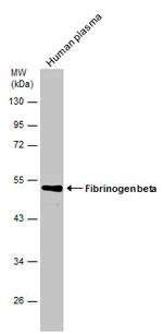 FIBB Antibody in Western Blot (WB)