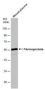 FIBB Antibody in Western Blot (WB)