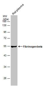 FIBB Antibody in Western Blot (WB)