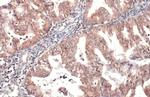 HYAL1 Antibody in Immunohistochemistry (Paraffin) (IHC (P))