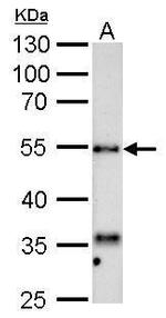 HYAL1 Antibody in Western Blot (WB)