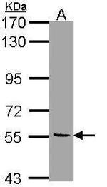 Monoamine Oxidase B Antibody in Western Blot (WB)