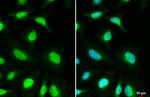 MSH3 Antibody in Immunocytochemistry (ICC/IF)