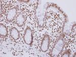 MSH3 Antibody in Immunohistochemistry (Paraffin) (IHC (P))