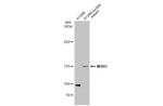 MSH3 Antibody in Western Blot (WB)