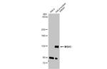 MSH3 Antibody in Western Blot (WB)