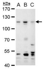 PMS2 Antibody in Western Blot (WB)