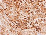 TPM1 Antibody in Immunohistochemistry (Paraffin) (IHC (P))