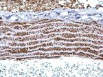 TPM1 Antibody in Immunohistochemistry (Paraffin) (IHC (P))