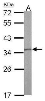 TPM1 Antibody in Western Blot (WB)