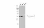 TPM1 Antibody in Western Blot (WB)