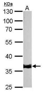 TPM1 Antibody in Western Blot (WB)