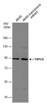 TRPC6 Antibody in Western Blot (WB)