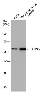 TRPC6 Antibody in Western Blot (WB)