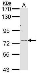 Calpain 10 Antibody in Western Blot (WB)