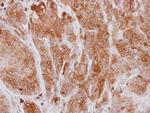 Coronin 1A Antibody in Immunohistochemistry (Paraffin) (IHC (P))