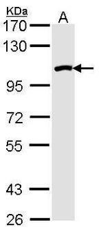 RAD54B Antibody in Western Blot (WB)